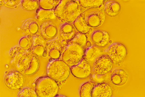 DHA Gold-Alge DHA Gold-Alge